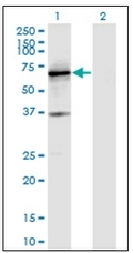 AM31935PU-N - PTPRN