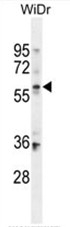 AP50362PU-N - BCMO1