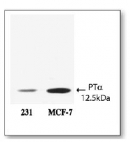 AP02198SU-S - Prothymosin alpha