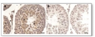 AP02198SU-S - Prothymosin alpha