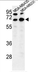 AP50368PU-N - Bestrophin-2