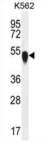 AP54414PU-N - alpha Tubulin / TUBA1C / TUBA6