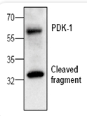 AP00185PU-N - PDPK1