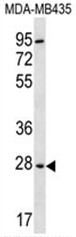 AP50385PU-N - Bisphosphoglycerate mutase