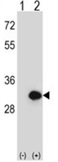 AP50385PU-N - Bisphosphoglycerate mutase