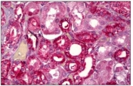 AP31828PU-N - GHRH receptor