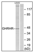 AP31828PU-N - GHRH receptor