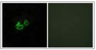 AP31828PU-N - GHRH receptor