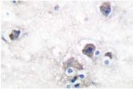 AP06284PU-N - Peripherin