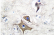 AP06253PU-N - Neuron specific enolase