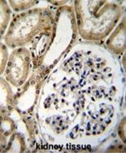 AP50394PU-N - BRUNOL6 / CELF6