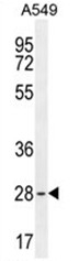 AP50403PU-N - BTF3