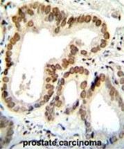 AP50404PU-N - BTG2