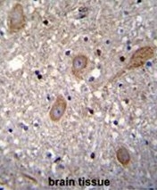 AP50409PU-N - FBW1A