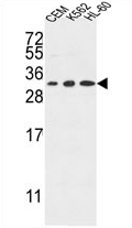 AP54377PU-N - Tetraspanin-2 (TSPAN2)