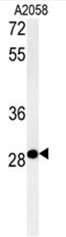 AP50428PU-N - C11orf46