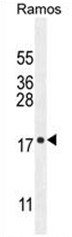 AP50431PU-N - C11orf53