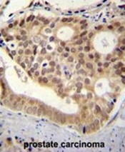 AP50431PU-N - C11orf53