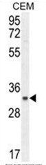 AP50438PU-N - C11orf74
