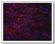 AM02032PU-S - Helicobacter pylori