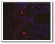 AP02034SU-S - Helicobacter pylori