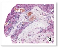 AP02135SU-N - Osteopontin / SPP1