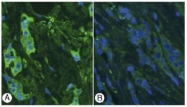 AP02233SU-S - Thymosin beta-4