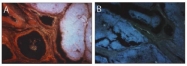 AP02235SU-S - Thymosin beta-4