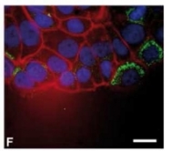 AP02229SU-S - Thymosin beta-10