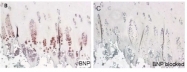 AM02178PU-S - Natriuretic peptides B