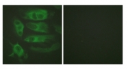 AP31835PU-N - Beta-2 adrenergic receptor