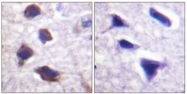 AP31835PU-N - Beta-2 adrenergic receptor