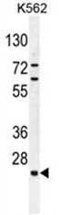 AP50477PU-N - C15orf41