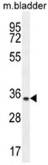 AP50477PU-N - C15orf41