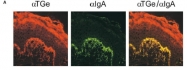 AP02094SU-S - Transglutaminase-3 (TGM3)