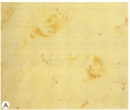 AP02084SU-S - Low Density Lipoprotein / LDL