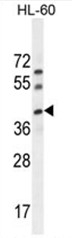 AP50497PU-N - C17orf59
