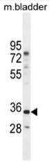 AP50497PU-N - C17orf59