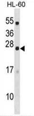 AP50504PU-N - C18orf26