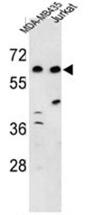 AP50511PU-N - DOS / C19orf26