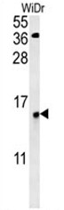 AP50516PU-N - C19orf50