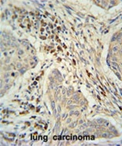 AP50516PU-N - C19orf50