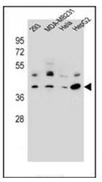 AP53748PU-N - RRAGC / Rag C
