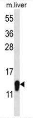 AP50534PU-N - C1orf144
