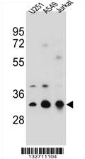 AP54345PU-N - Tropomyosin-4 (TPM4)