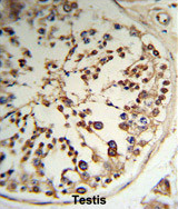 AP54344PU-N - Thiamine pyrophosphokinase 1 (TPK1)