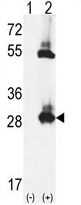 AP54344PU-N - Thiamine pyrophosphokinase 1 (TPK1)