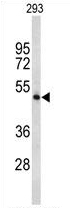 AP54343PU-N - Tryptophan 5-hydroxylase 2 (TPH2)
