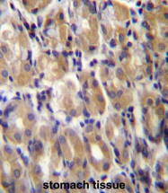 AP54336PU-N - Torsin-1B (TOR1B)