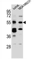 AP54327PU-N - TNRC4 / BRUNOL1